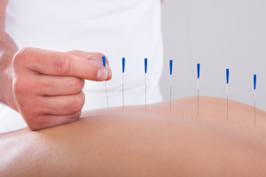 acupuncture to help digestion, back pain, stress