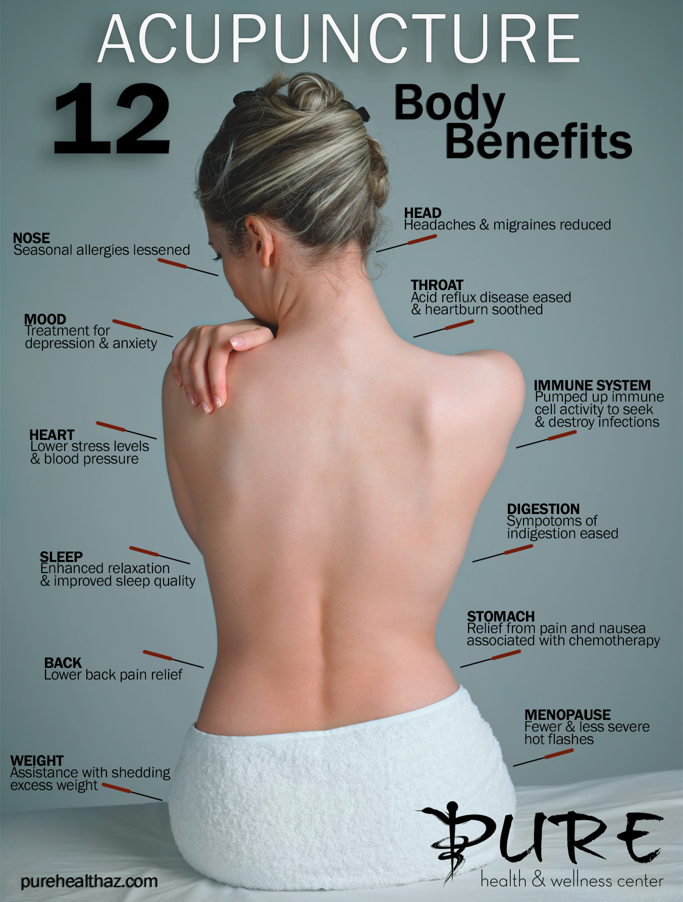 12 body benefits to receiving Anthem acupuncture 