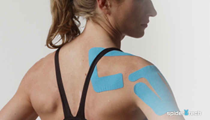 A Guide to Kinesiology Taping from our Own SpiderTech Expert